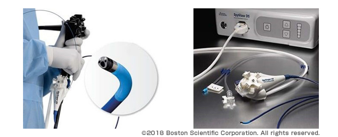 スパイグラスDS胆管・膵管鏡システム