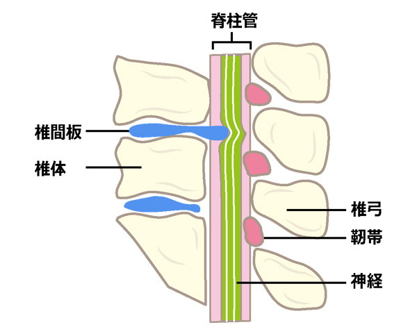 手根管症候群
