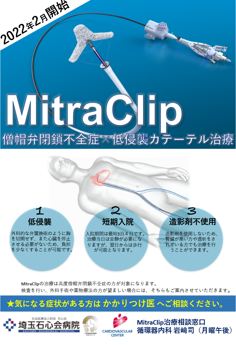 カテーテル治療「MitraClip」