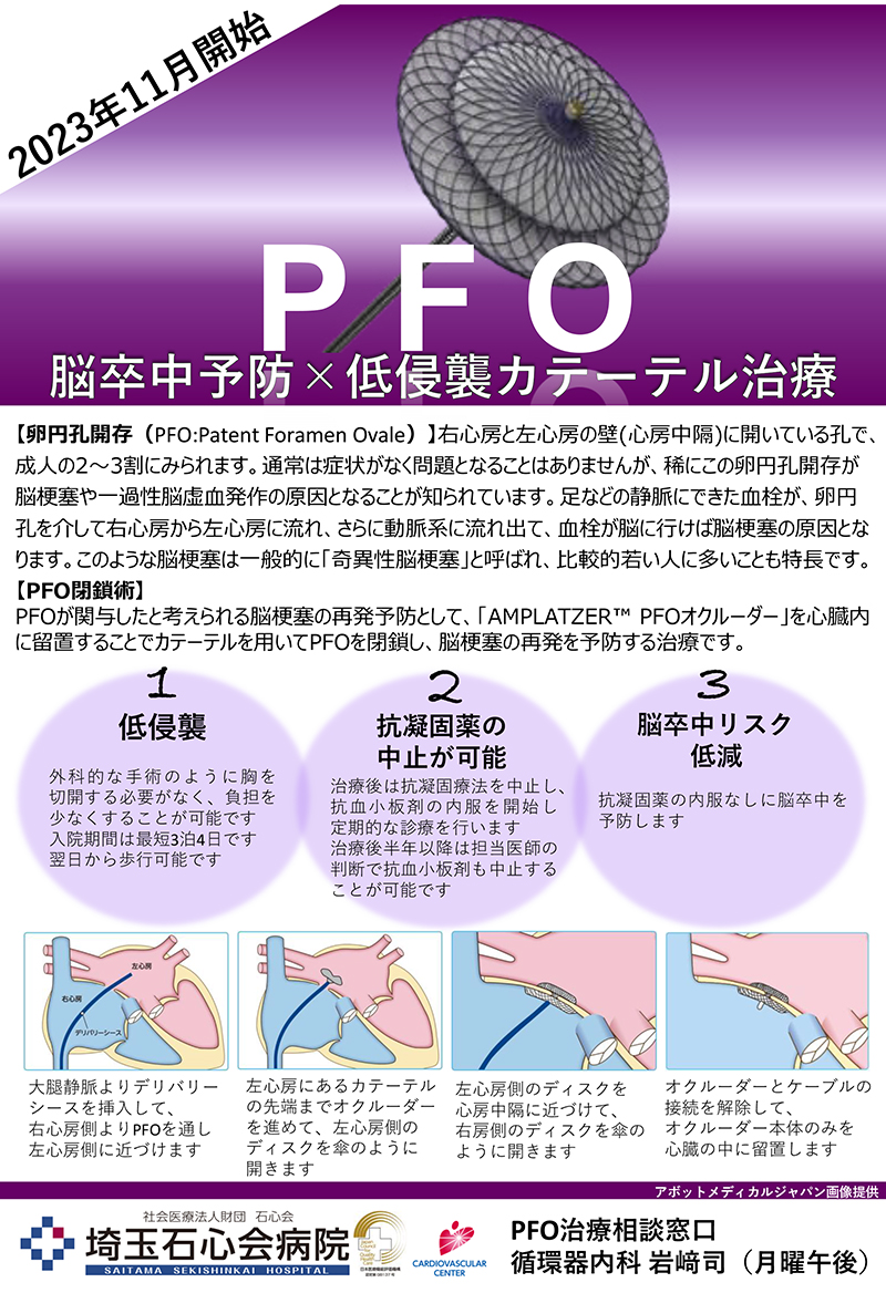 PFO閉鎖術